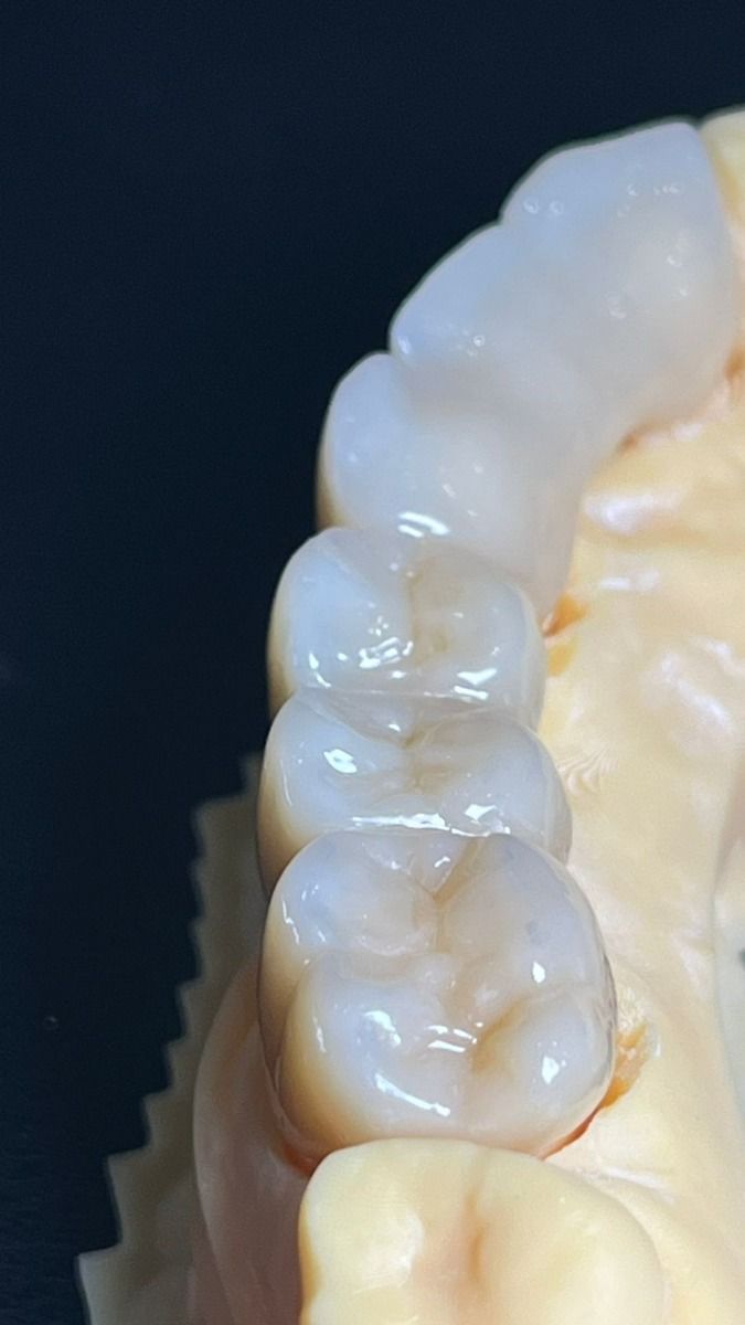Effect of laser and coating surface treatment on the bond strength of zirconia ceramics