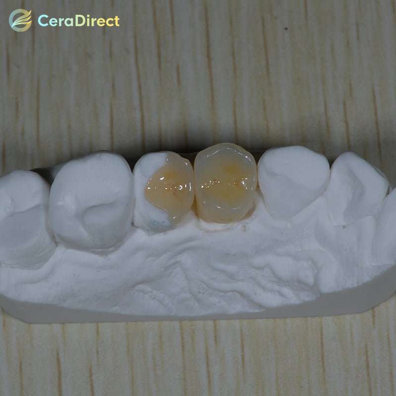 Lithium Disilicate Block(Glass Ceramic)—B32-HT/LT(5 pieces) - CeraDirect